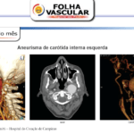 cirurgiao-vascular-dr-daniel-benitti-Folha-Vascular-156