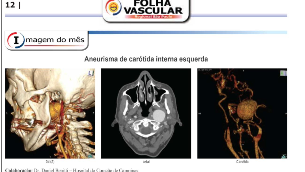 Folha-Vascular-156-–-Cirurgião-Vascular