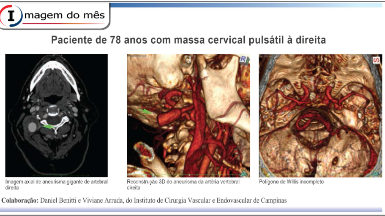 Folha-Vascular-163-–-Cirurgião-Vascular