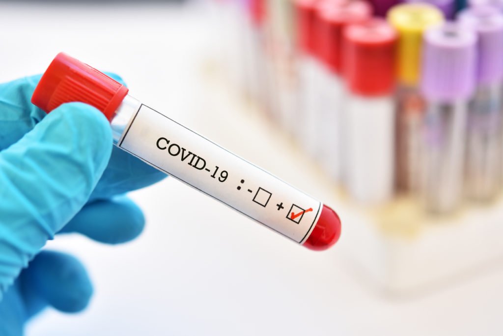 coronavirus-covid-19-positivo-dr-daniel-benitti-cirurgiao-vascular-sao-paulo-campinas.jpg