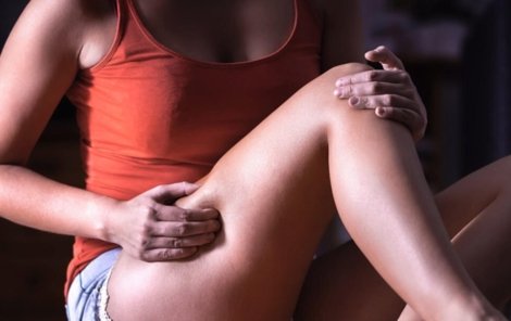 inflamacao-pernas-lipedema-dr-daniel-benitti-cirurgiao-vascular-sao-paulo-campinas