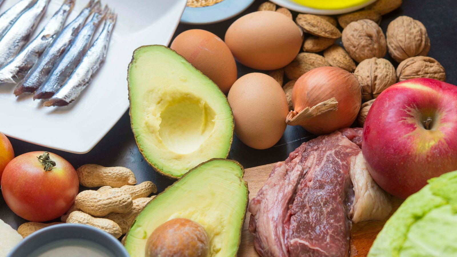 Ketogenic diet