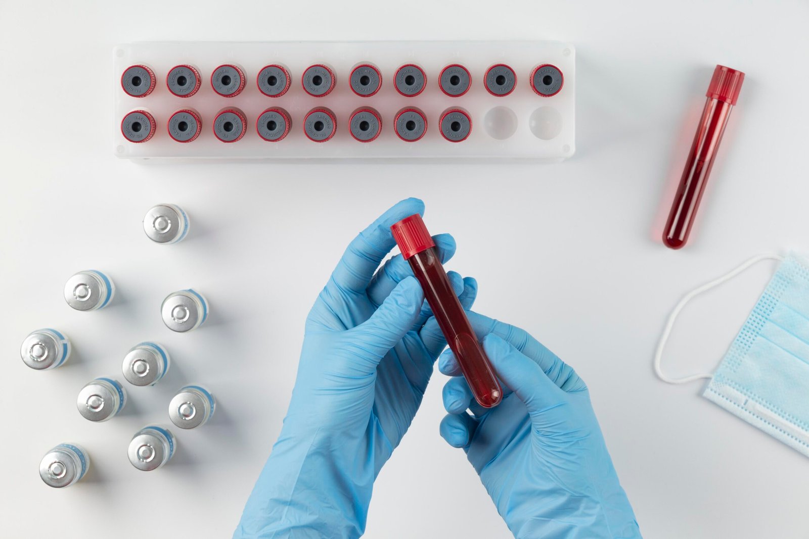 Proteína C reativa (PCR) . Você já ouviu falar deste exame de sangue? Cirurgião Vascular Proteína C reativa (PCR) . Você já ouviu falar deste exame de sangue? Cirurgião Vascular